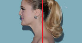 Forward Head Posture - Drew Barrymore